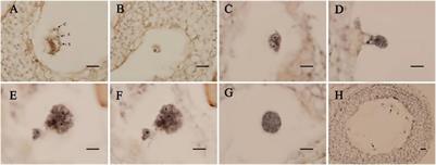 Induction and Characterization of Tetraploid Through Zygotic <mark class="highlighted">Chromosome Doubling</mark> in Eucalyptus urophylla